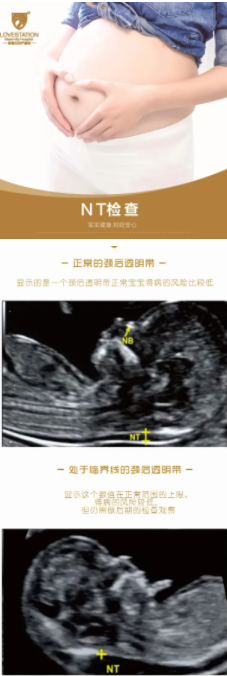 20210306102831407067.png 微信截图_20210306102533.png